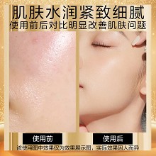 安婕妤 臻美金纯抗皱蛋白精华水150ml 补水保湿、紧实弹嫩、赋活淡纹、水嫩滋养、细腻丝滑、改善干燥