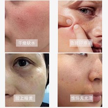 素妍嫤 美/白祛/斑精华液30ml 润白焕亮、淡化色斑、抵御氧化、预防色素沉着、改善肤色暗沉无光泽状态