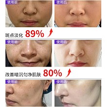 欧恪米兰 美/白祛/斑面膜25ml*6片