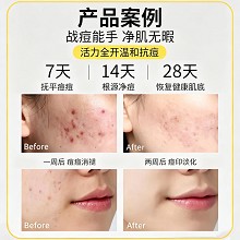 雅梵哲 初肌清盈霜50g(净化霜)净化收敛、清透洁净、平衡水油、改善粗糙毛孔/粉刺/痘痘肌肤